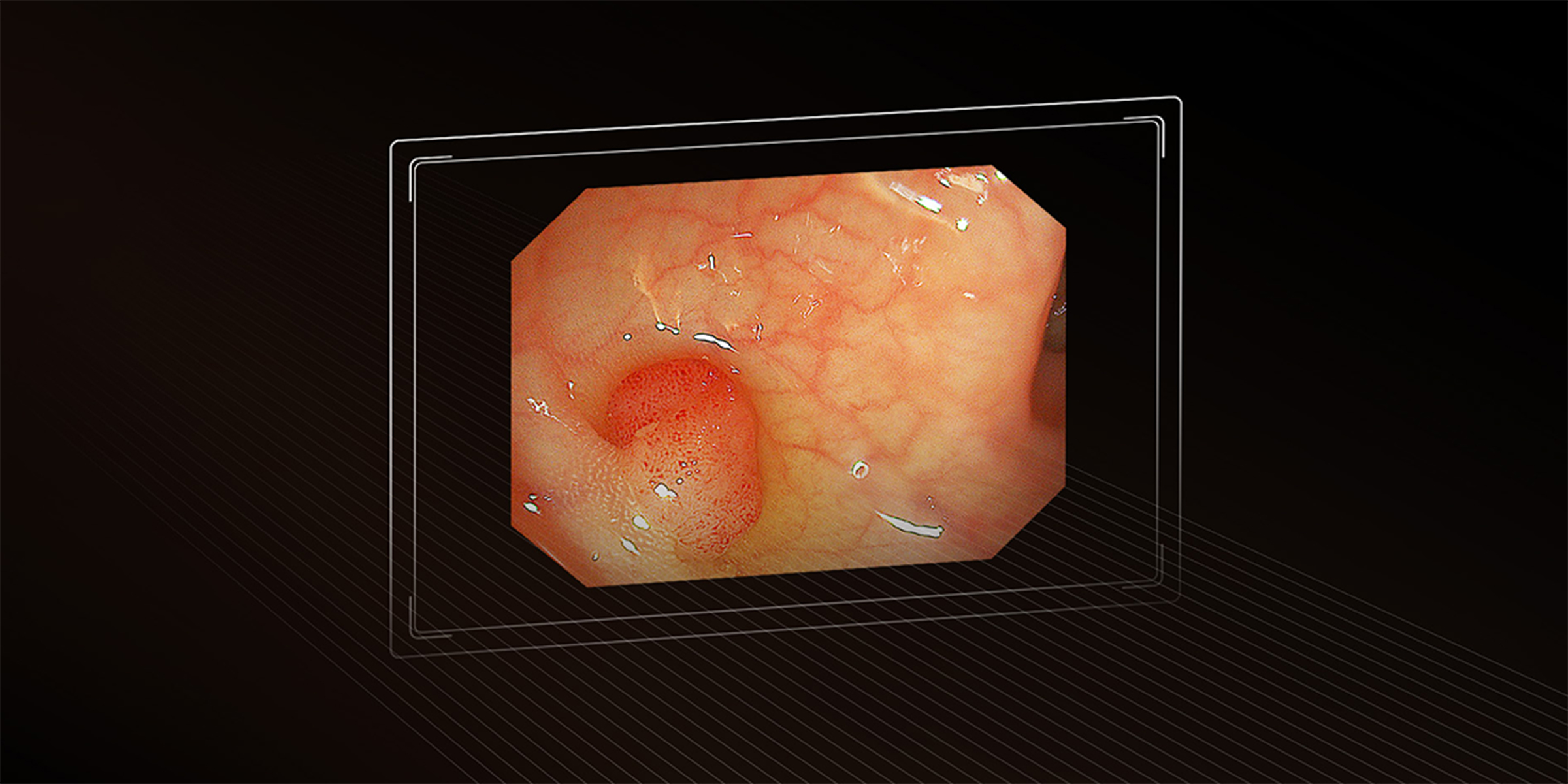 Видеоколоноскоп Aohua VCC-Q30JL фото6