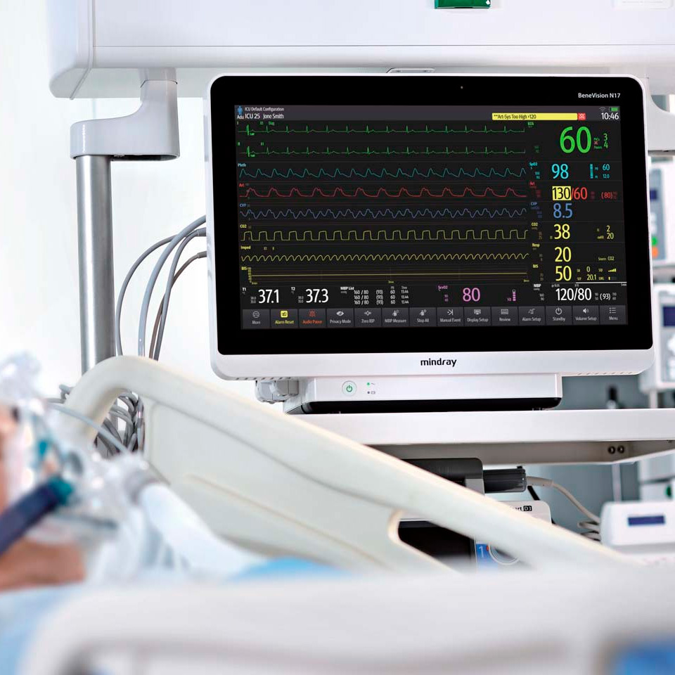 Монитор пациента Mindray BeneVision N17  фото3