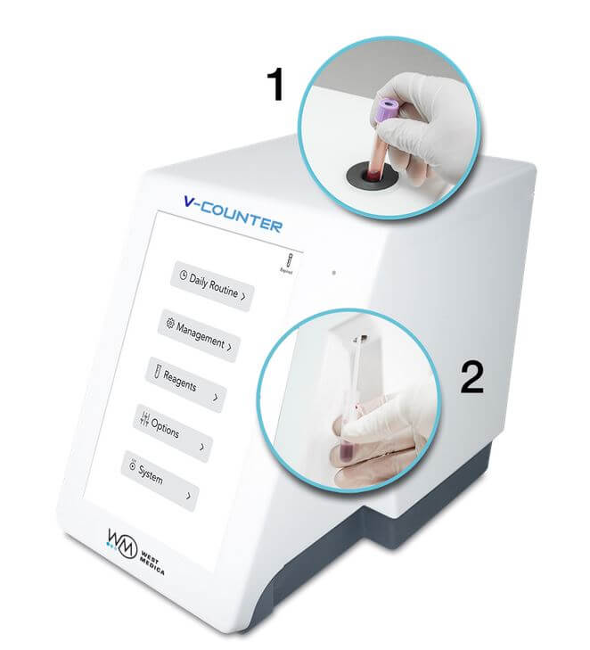 Автоматический гематологический анализатор V-Counter на 22 параметра фото2