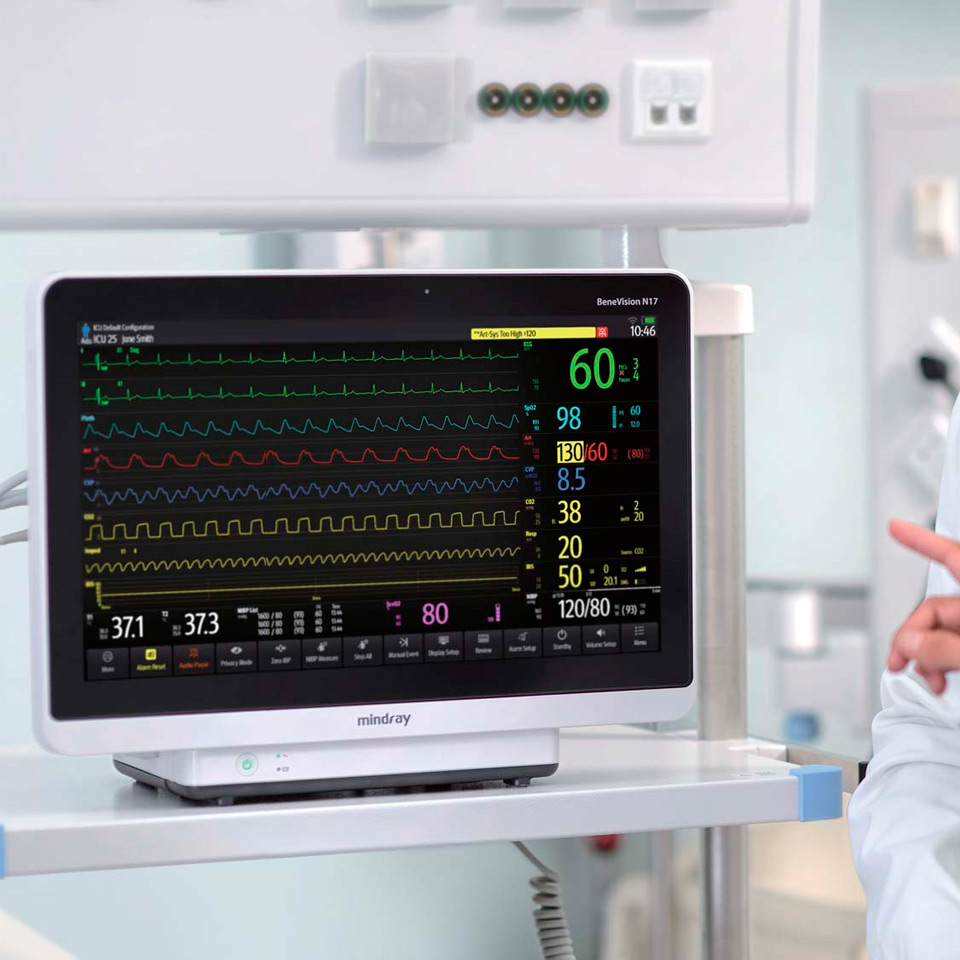 Монитор пациента Mindray BeneVision N17  фото4