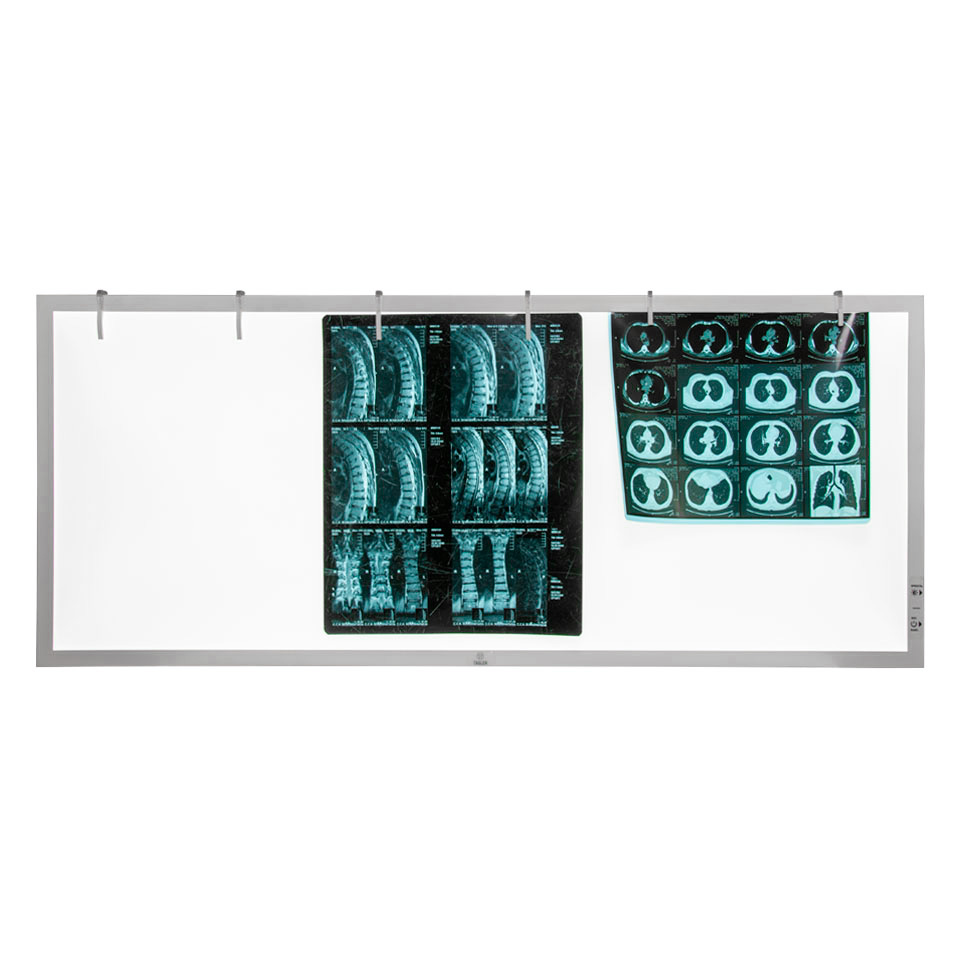 Трёхкадровый медицинский светодиодный негатоскоп ТАГЛЕР НСД-3 фото3