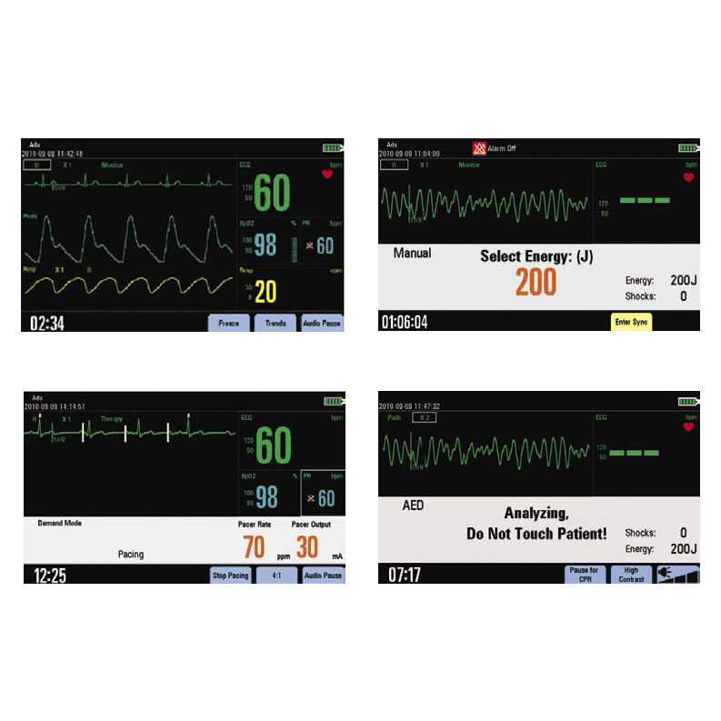Дефибриллятор-монитор Mindray BeneHeart D3 с функцией электрокардиостимуляции фото2 Дефибриллятор-монитор Mindray BeneHeart D3 с функцией электрокардиостимуляции фото2