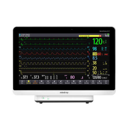 Монитор пациента Mindray BeneVision N17  фото1
