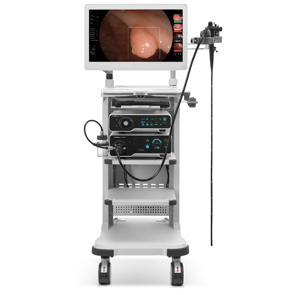 Видеоэндоскопическая cистема SonoScape HD-550: фотографии