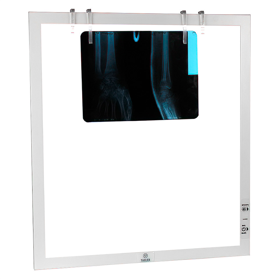 Однокадровый медицинский светодиодный негатоскоп ТАГЛЕР НСД-1 фото2 Однокадровый медицинский светодиодный негатоскоп ТАГЛЕР НСД-1 фото2