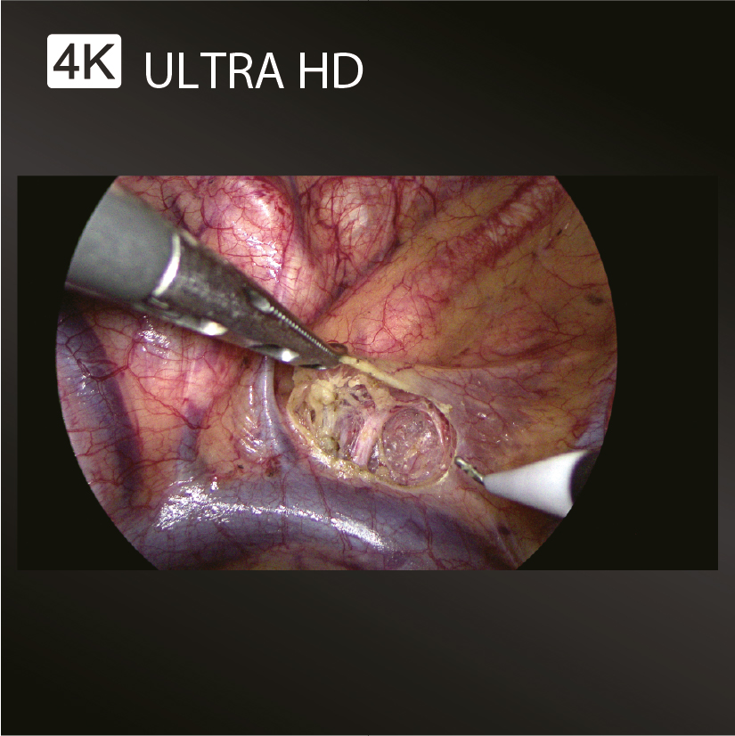 Видеоэндоскопическая система Mindray HyPixel U1 (4K UHD) фото6