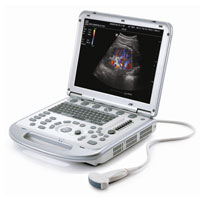УЗИ-аппараты для гинекологии: фотографии