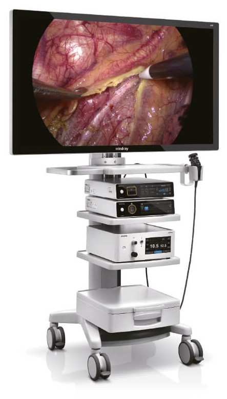 Видеоэндоскопическая система Minday HyPixel U1 (4K).