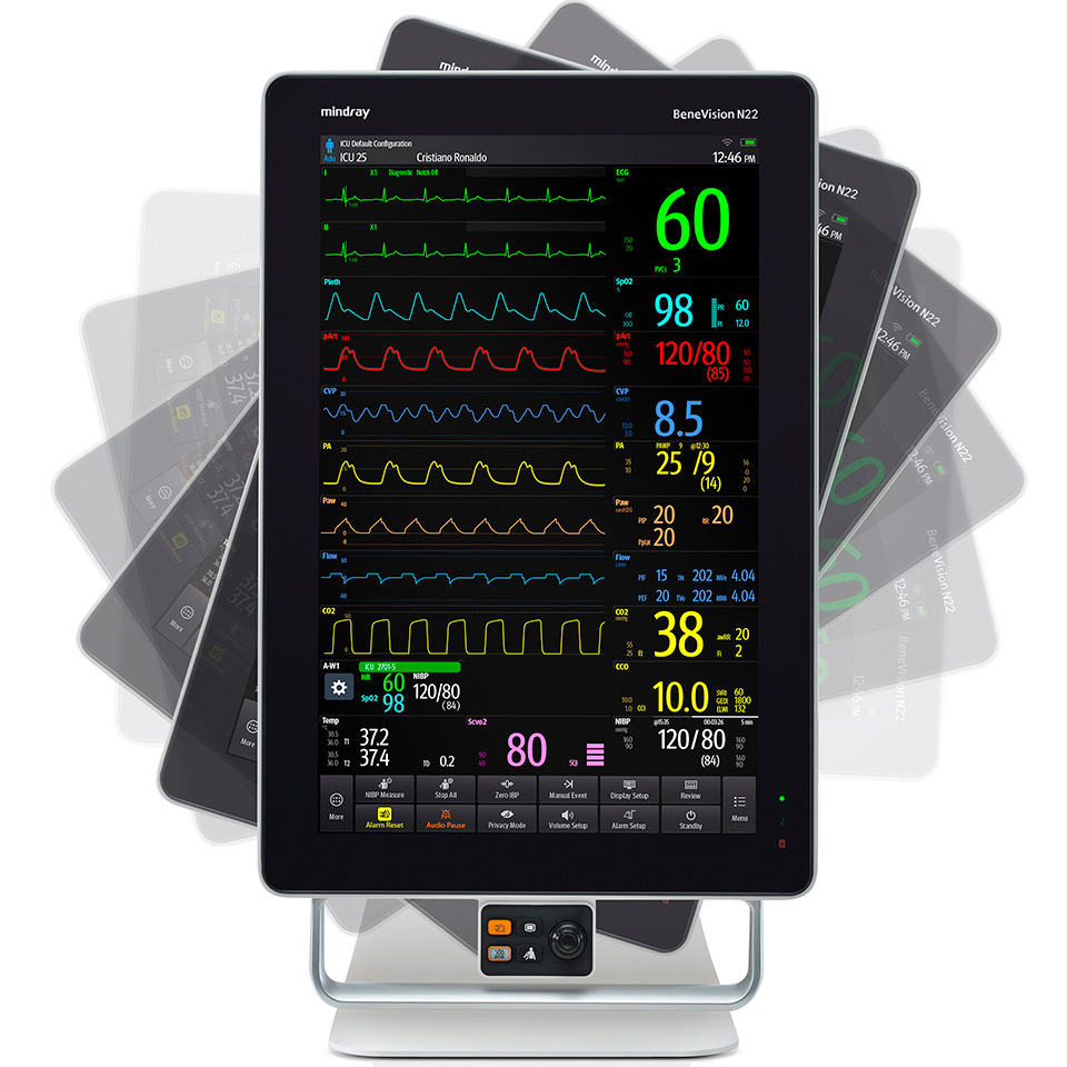 Монитор пациента Mindray BeneVision N19  фото1