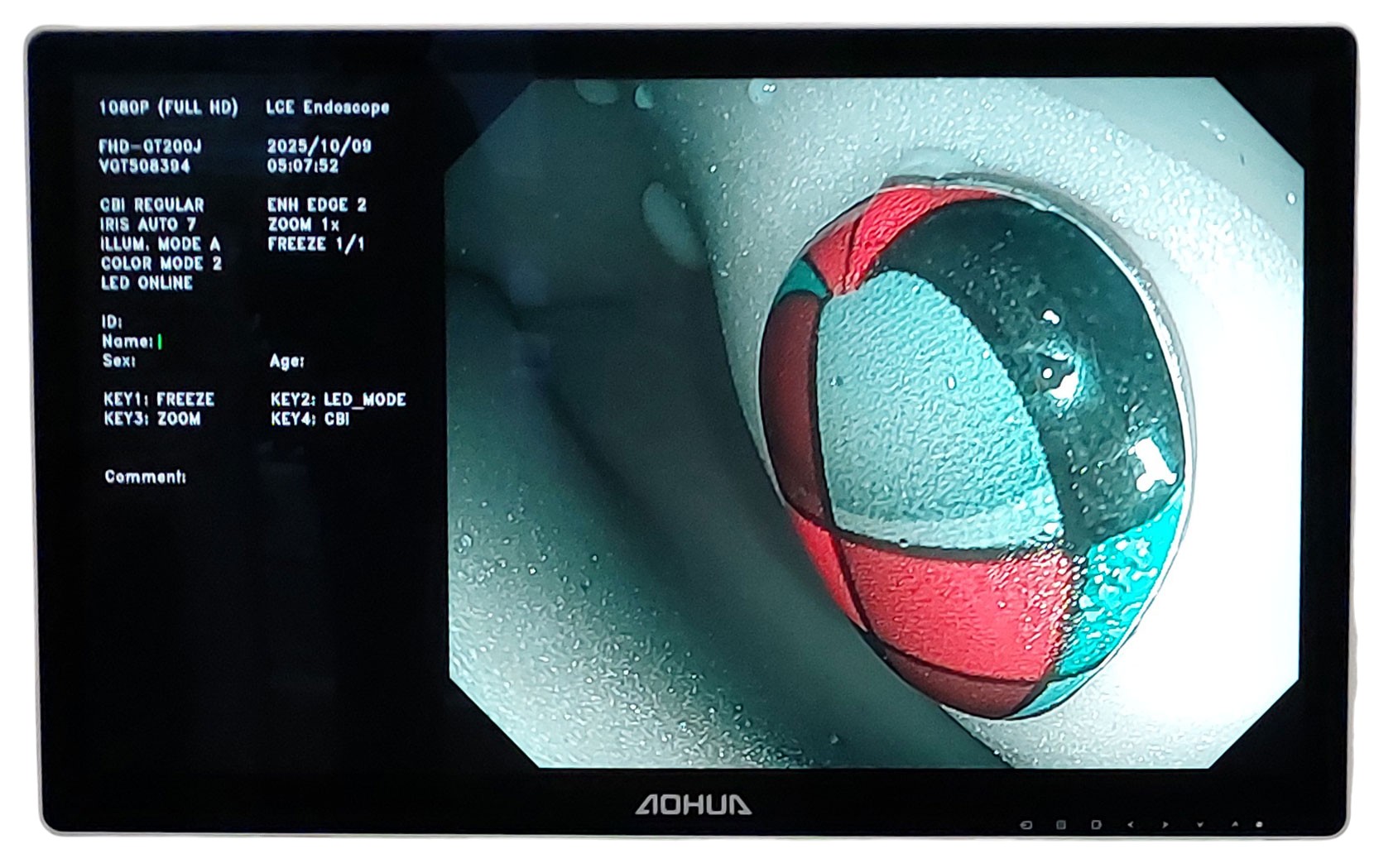 Видеоэндоскопическая система Aohua AQ-200 фото9